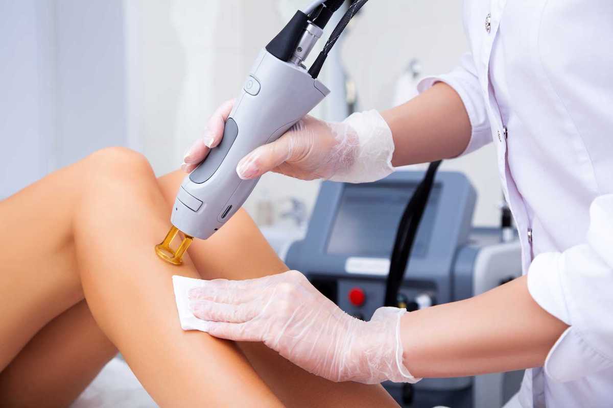 woman receiving laser hair removal treatment